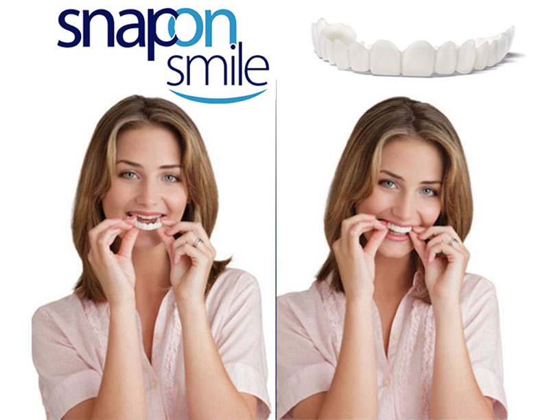 s-on-s
