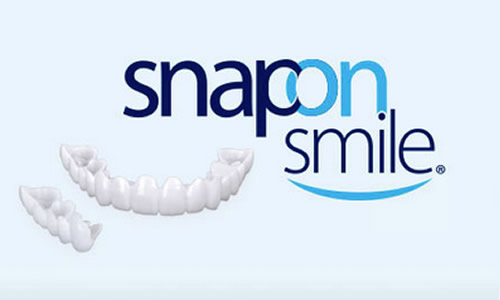 s-on-smile-1